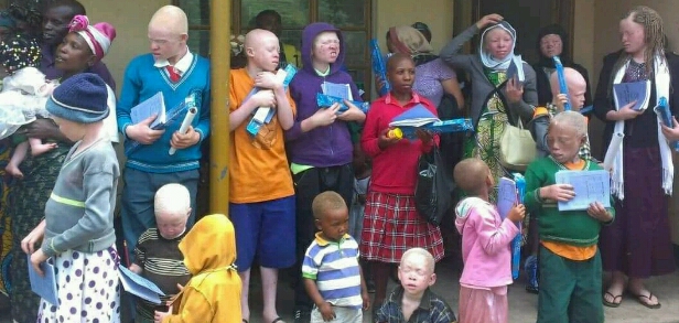 Kisoro children with albinism after receiving school items