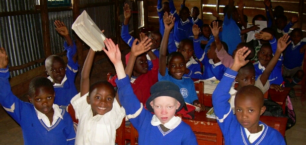 person with albinism in classroom