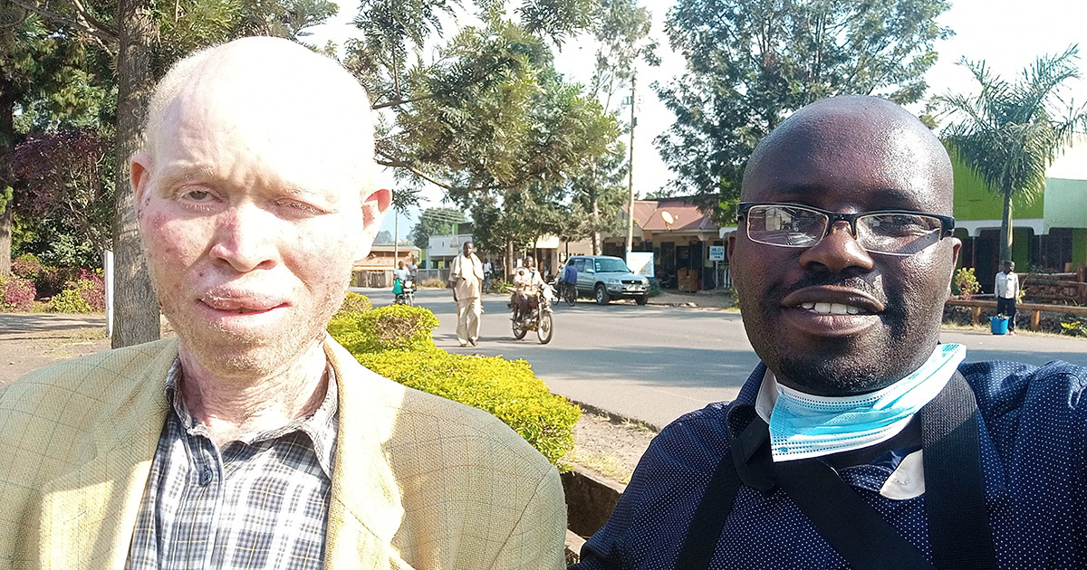 Person with Albinism in Kisoro Living in Fear after Failing to Go for Skin Cancer Treatment