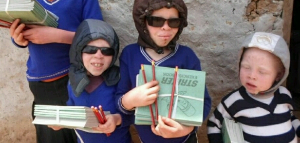 children with albinism after receiving scholastic materials