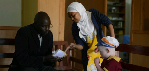 treatment for sunburns for person with albinism